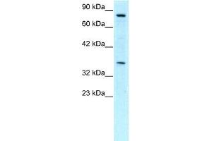 Human Jurkat; WB Suggested Anti-NPAS1 Antibody Titration: 0. (NPAS1 anticorps  (C-Term))