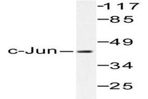 Image no. 1 for anti-Jun Proto-Oncogene (JUN) antibody (ABIN265355) (C-JUN anticorps)