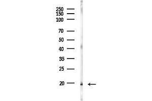 anti-Replication Protein A3, 14kDa (RPA3) (Internal Region) antibody