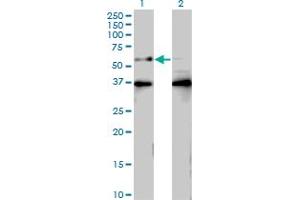 Western Blot analysis of BTBD9 expression in transfected 293T cell line by BTBD9 monoclonal antibody (M01), clone 3H3. (BTBD9 anticorps  (AA 2-70))
