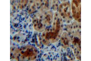 Used in DAB staining on fromalin fixed paraffin-embedded kidney tissue