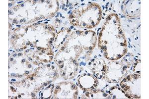 Immunohistochemical staining of paraffin-embedded Ovary tissue using anti-ACO2mouse monoclonal antibody. (ACO2 anticorps)