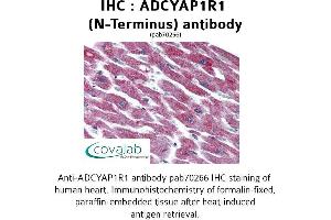 Image no. 1 for anti-Adenylate Cyclase Activating Polypeptide 1 (Pituitary) Receptor Type I (ADCYAP1R1) (Extracellular Domain), (N-Term) antibody (ABIN1731540)