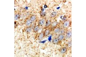 Immunohistochemical analysis of HSD17B2 staining in rat brain  formalin fixed paraffin embedded tissue section. (HSD17B2 anticorps)