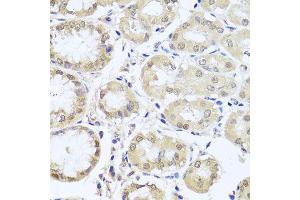 Immunohistochemistry of paraffin-embedded human stomach using CGB7 antibody (ABIN5974696) at dilution of 1/100 (40x lens). (CGB7 anticorps)