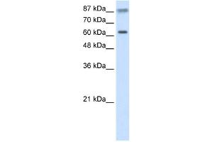 WB Suggested Anti-TRIM35 Antibody Titration:  2. (TRIM35 anticorps  (C-Term))