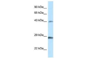 Western Blot showing Hoxb9 antibody used at a concentration of 1.