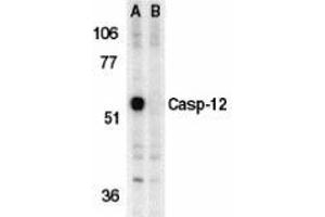 Western blot analysis of caspase-12 in mouse brain tissue lysate in the absence (A) or presence (B) of blocking peptide with AP30191PU-N caspase-12 antibody (IN) at 1 μg/ml. (Caspase 12 anticorps  (Intermediate Domain))