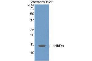 Western Blotting (WB) image for anti-Complement Component 4 Binding Protein, alpha (C4BPA) (AA 358-469) antibody (ABIN3206346) (C4BPA anticorps  (AA 358-469))