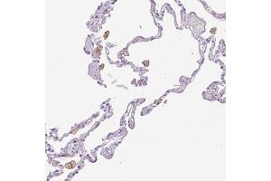 Immunohistochemical staining (Formalin-fixed paraffin-embedded sections) of human lung with SIGLEC1 polyclonal antibody  shows distinct membranous positivity in macrophages. (Sialoadhesin/CD169 anticorps  (AA 1425-1510))