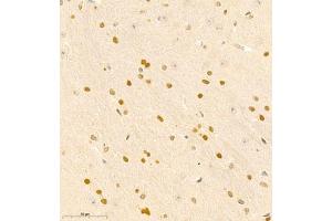 Immunohistochemistry of paraffin embedded mouse brain using RAPGEF5 (ABIN7075365) at dilution of 1:700 (400x lens) (GFR anticorps)