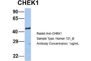 Host: Rabbit Target Name: CHEK1 Sample Type: 721_B Antibody Dilution: 1.