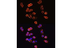 Immunofluorescence analysis of R.