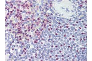 Spleen, Human: Formalin-Fixed, Paraffin-Embedded (FFPE) (PKD1 anticorps)