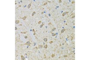 Immunohistochemistry of paraffin-embedded mouse brain using DHRS2 antibody.