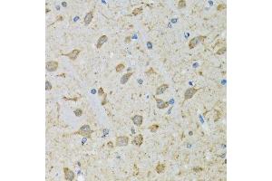 Immunohistochemistry of paraffin-embedded mouse brain using DHRS2 antibody. (DHRS2 anticorps  (AA 1-300))