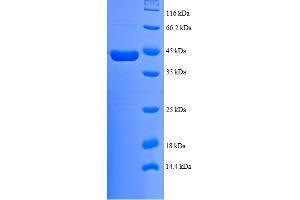 SDS-PAGE (SDS) image for NADH Dehydrogenase (Ubiquinone) 1 beta Subcomplex, 7, 18kDa (NDUFB7) (AA 2-137) protein (GST tag) (ABIN5712165)