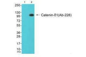 anti-Catenin (Cadherin-Associated Protein), delta 1 (CTNND1) (Tyr228) antibody