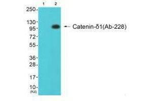 Western blot analysis of extracts from 293 cells (Lane 2), using Catenin-δ1 (Ab-228) antiobdy. (CTNND1 anticorps  (Tyr228))