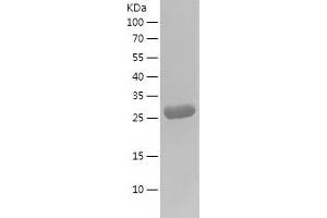 Galectin 3 (LGALS3) (AA 2-250) protein (His tag)