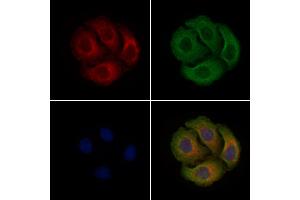 ABIN6255757 and ABIN6267340 staining Hela cells(4h of LPS treatment) by IF/ICC. (c-MET anticorps  (pTyr1003))