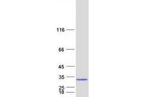 Validation with Western Blot