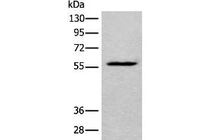 Western blot analysis of HEPG2 cell lysate using LDHD Polyclonal Antibody at dilution of 1:400 (LDHD anticorps)
