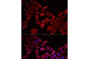 Immunofluorescence analysis of MCF7 cells using Caspase-14 Polyclonal Antibody (CASP14 anticorps)