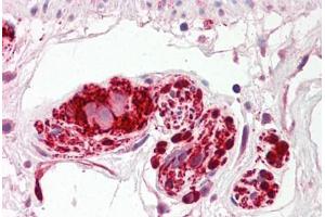 Image no. 2 for anti-Intraflagellar Transport 172 Homolog (IFT172) (AA 360-409) antibody (ABIN6749751) (IFT172 anticorps  (AA 360-409))