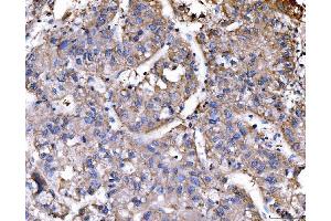 IHC analysis of RAE1 using anti-RAE1 antibody (ABIN7602428). (RAE1 anticorps  (AA 76-368))