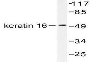 Image no. 1 for anti-Keratin 16 (KRT16) antibody (ABIN265495) (KRT16 anticorps)