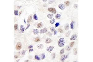Immunohistochemistry (IHC) image for anti-Integrator Complex Subunit 7 (INTS7) (AA 850-900) antibody (ABIN7449405) (INTS7 anticorps  (AA 850-900))