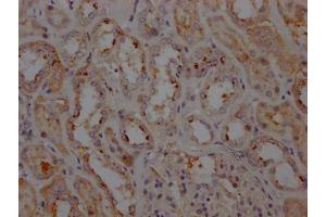 IHC image of  diluted at 1:100 and staining in paraffin-embedded human kidney tissue performed on a Leica BondTM system. (Recombinant LRRK2 anticorps)