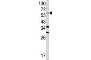 Western blot analysis of YAP antibody and NCI-H460 lysate. (YAP1 anticorps  (AA 420-446))