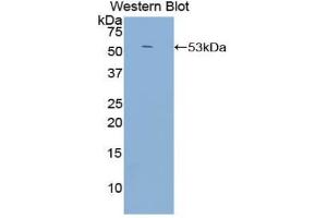 Western blot analysis of the recombinant protein. (CD21 anticorps  (AA 729-957))
