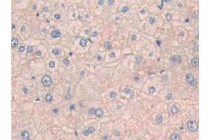 Detection of CPN1 in Human Liver Tissue using Polyclonal Antibody to Carboxypeptidase N1 (CPN1)
