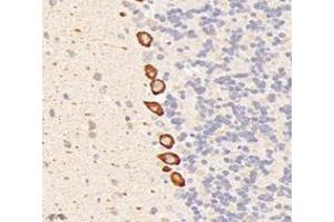 Immunohistochemistry analysis of paraffin-embedded rat cerebellum using,Dgkz (ABIN7073722) at dilution of 1: 6000