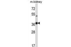 Western Blotting (WB) image for anti-Testis-Specific Serine Kinase 6 (TSSK6) antibody (ABIN2997885)