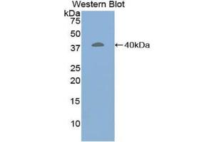 Detection of Recombinant CRN, Human using Polyclonal Antibody to Corin (CRN)