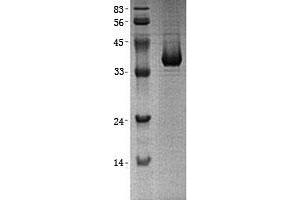 Validation with Western Blot (LDHB Protein (Transcript Variant 2) (His tag))