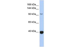 WB Suggested Anti-ZBTB4 Antibody Titration: 0. (ZBTB4 anticorps  (Middle Region))