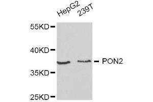 Western blot analysis of extracts of various cell lines, using PON2 antibody. (PON2 anticorps  (AA 1-210))