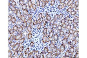 IHC analysis of OAT2/SLC22A7 using anti-OAT2/SLC22A7 antibody (ABIN7601355).