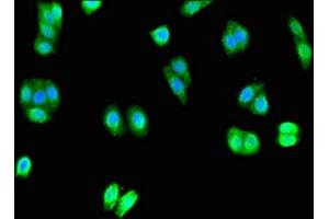 anti-Unc-80 Homolog (UNC80) (AA 124-388) antibody