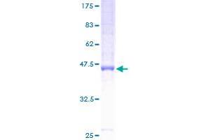 Image no. 1 for Neuron-Specific Protein Family Member 2 (HMP19) (AA 1-171) protein (GST tag) (ABIN1306841)