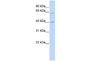 TRIT1 antibody used at 0. (TRIT1 anticorps  (Middle Region))