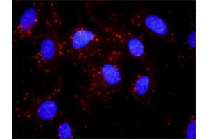 Proximity Ligation Analysis of protein-protein interactions between AKT1 and HSPB1.