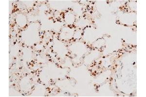 ABIN6267524 at 1/200 staining Rat lung tissue sections by IHC-P.