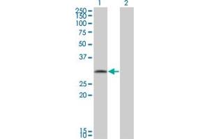 Western Blot analysis of FGFR1OP2 expression in transfected 293T cell line by FGFR1OP2 monoclonal antibody (M01), clone 2G4.