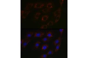 Immunofluorescence analysis of NIH-3T3 cells using BC Rabbit pAb (ABIN6131008, ABIN6137483, ABIN6137484 and ABIN6223295) at dilution of 1:100 (40x lens).